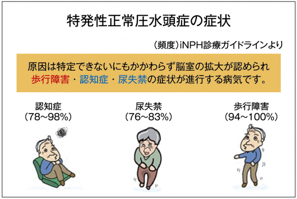 神経障害の症状は何ですか?